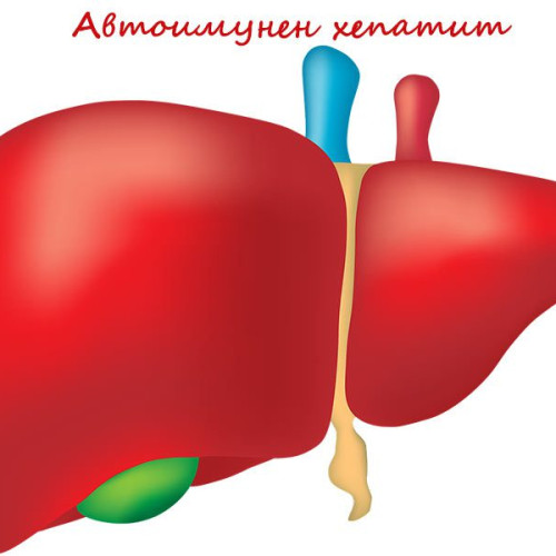 Какво е автоимунен хепатит?